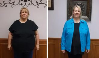 Two women before and after a weight loss.