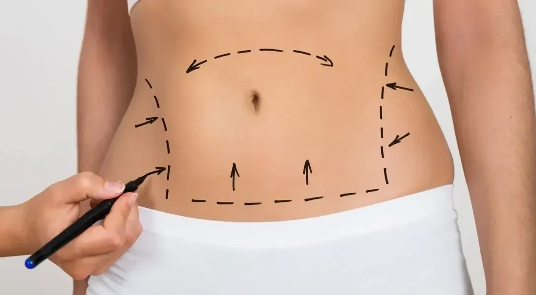 A woman is drawing lines on her stomach.